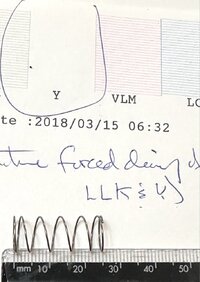 spring from beneath P5000 printhead.jpg